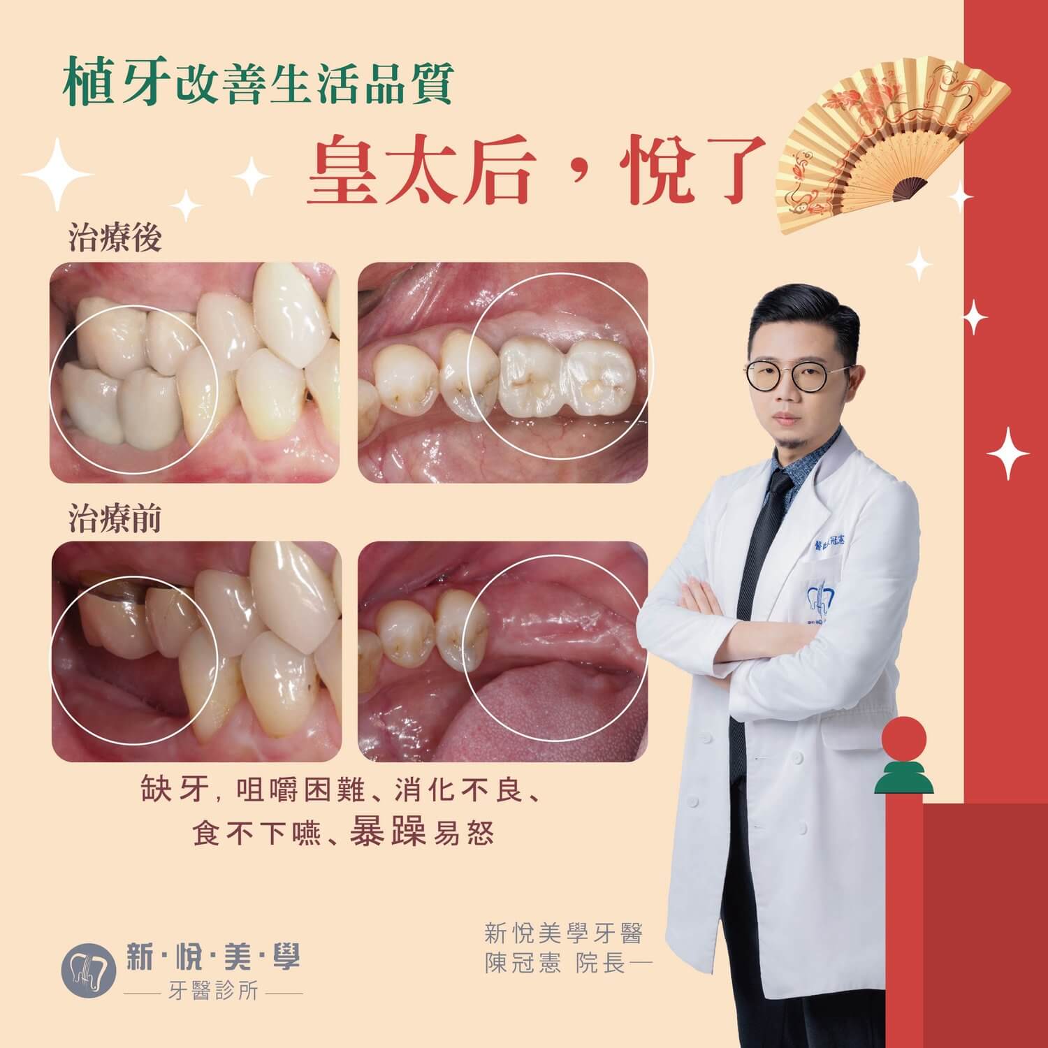 新悅美學牙醫診所的案例分享圖片